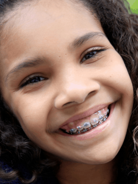 Orthodontic-treatment-kids