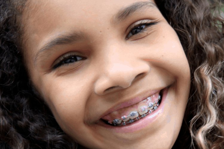 Orthodontic-treatment-kids